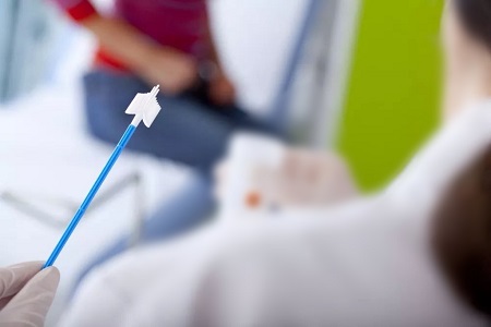 Достижения в скрининге рака шейки матки: роль тестов на HPV на самооблавление