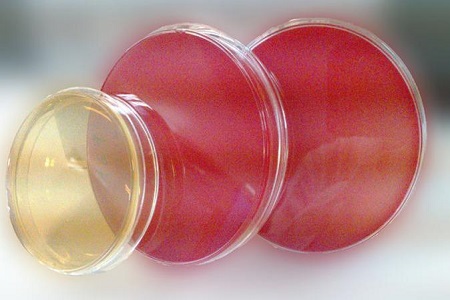 Salmonella Shigella Agar (SS): основная среда для выделения патогена