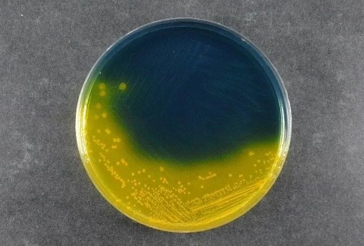 Обеспечение безопасности пищевых продуктов: Salmonella Shigella Agar (SS) от Babio поддерживает глобальные стандарты обнаружения патогенов