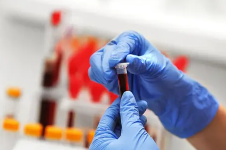 BABIO запускает флуоресцентный экспресс-тест на беременность для крупного рогатого скота